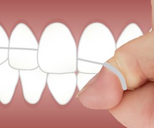 Zahnseide Gingivitis